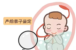 鄂尔多斯孕期亲子鉴定正规中心在什么地方，鄂尔多斯孕期亲子鉴定准确吗